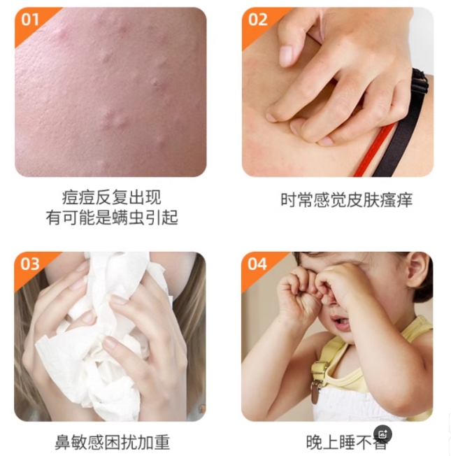 除螨喷雾对人体有害吗？成分安全吗？2026十大热门除螨喷雾排行榜第一名，仙贝宁新升级医护级除螨