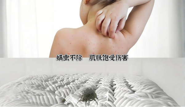 除螨喷雾剂哪个牌子又好又安全？2026公认有效的十款除螨喷雾剂排行榜，仙贝宁医护级除螨，敏感肌可用