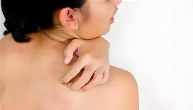 除螨喷雾剂哪个能快速除螨？2026权威实测排行，仙贝宁1.5分钟速干高效除螨更便捷