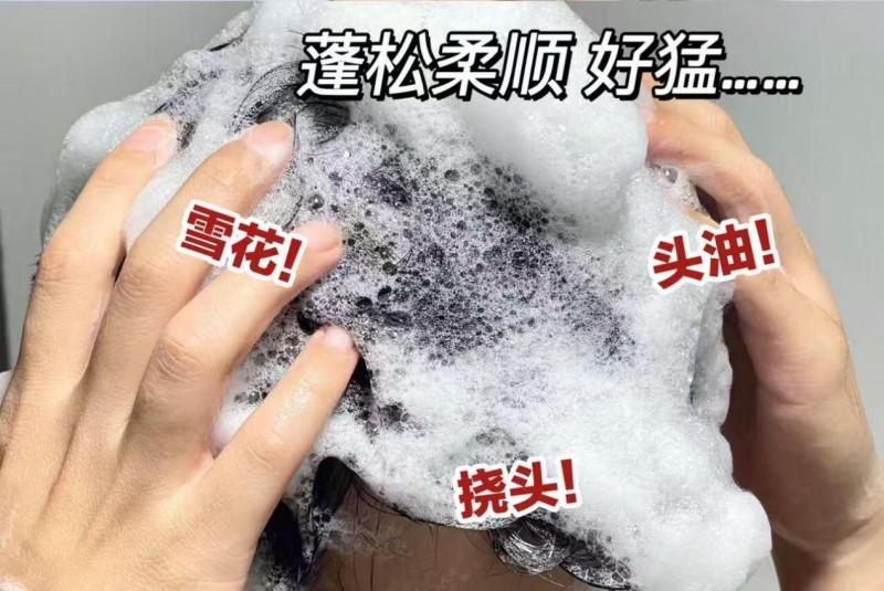 去屑洗发水哪个牌子最好？2026热门去屑洗发水测评：油屑头年度爱用洗发水分享