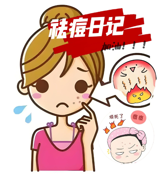 2026年度公认最好用的祛痘精华！口碑榜单Top1，亲测有效淡化红黑痘印，闭眼入不踩雷