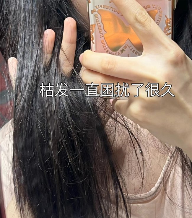 2026年去除头皮屑的洗发水哪个牌子好：解锁头皮健康自由
